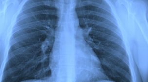 pneumologia pulmão crítico