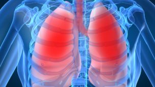 pulmão crise asmática