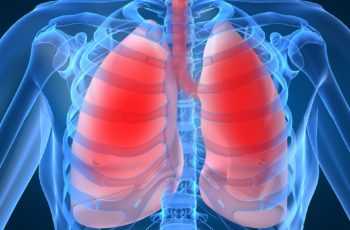 pulmão crise asmática